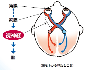 視神経炎の症例写真1
