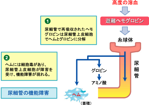 図1−ハプトグロビン製剤 図1−ハプトグロビン製剤